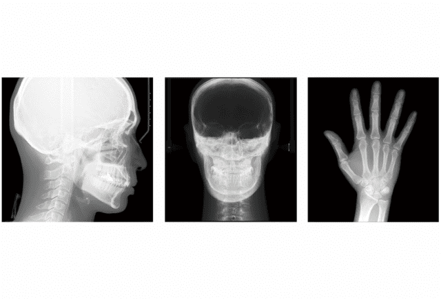 歯科用CT・パノラマ・セファロ】PreXion3D EXPEDITION｜株式会社近畿レントゲン工業社「X線 をつくるところから活かすところまで」1946年創業の歯科用CT・耳鼻科用CT・歯科用レントゲン・工業用X線装置のメーカーです。