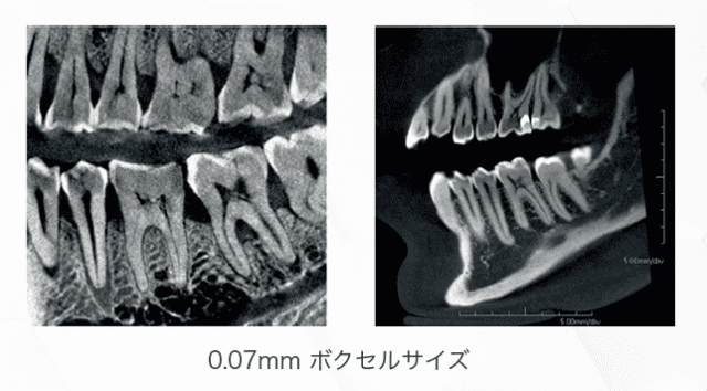 歯科用CT・パノラマ・セファロ】PreXion3D EXPLORER  PRO｜株式会社近畿レントゲン工業社「X線をつくるところから活かすところまで」1946年創業の歯科用CT・耳鼻科用CT・歯科用レントゲン・工業用 X線装置のメーカーです。