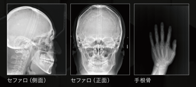 歯科用CT・パノラマ・セファロ】PreXion3D EXPLORER PRO｜株式会社近畿レントゲン工業社「X線 をつくるところから活かすところまで」1946年創業の歯科用CT・耳鼻科用CT・歯科用レントゲン・工業用X線装置のメーカーです。