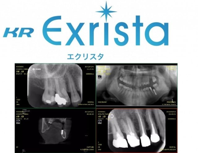 患者画像管理ソフト】KR Exrista 3D+｜株式会社近畿レントゲン工業社 